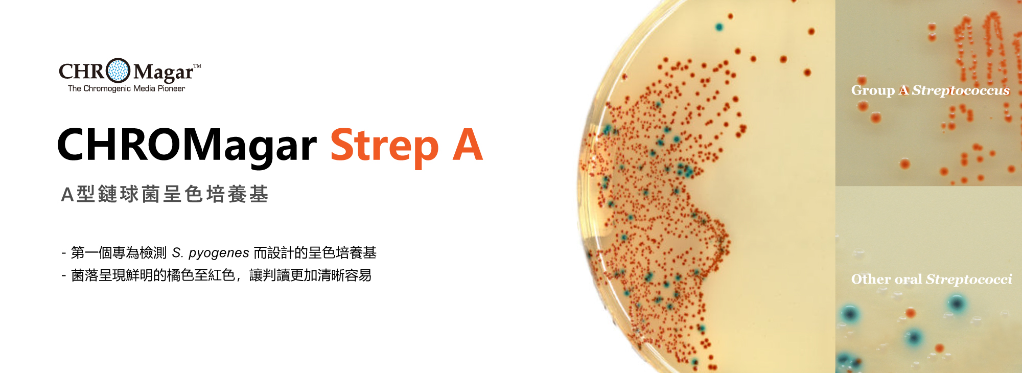 CHROMagar Strep A